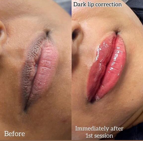 Permanent Lipstick at Facethetics Beauty, Delhi