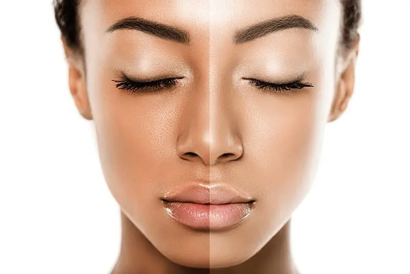 Best Skin Lightening Treatment