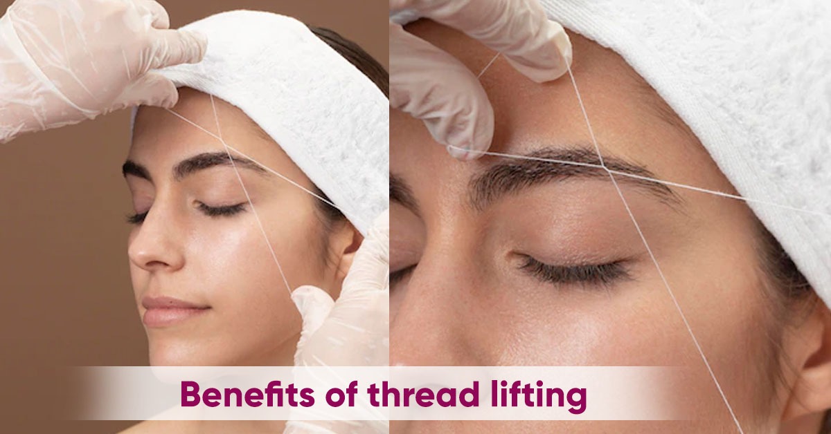 Benefits of Thread lifting