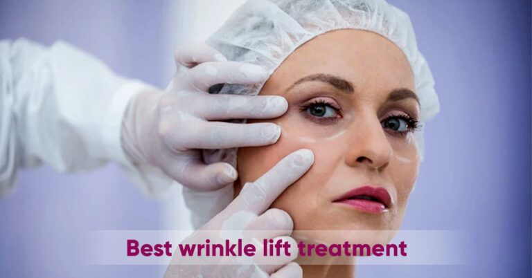 Wrinkle lift treatment