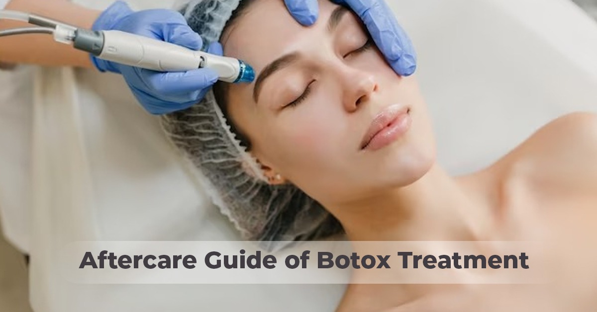 Guide of Botox Treatment