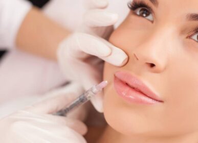 Dermal Fillers Smile Line