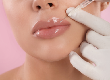 Lip Fillers